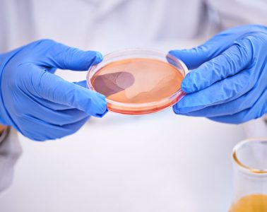 What is a « sudden » illness ?